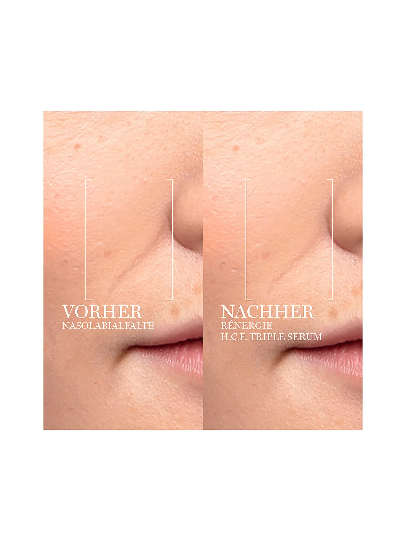 LANCÔME | Rénergie Multi-Lift Ultra Triple Serum 50ml | keine Farbe