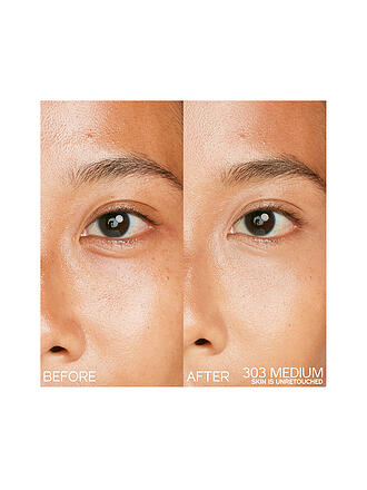 SHISEIDO | Synchro Skin Radiant Lifting Concealer 203